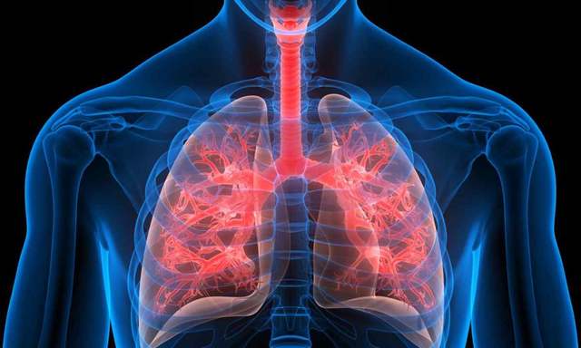 На Рівненщині зростає захворюваність на туберкульоз: медики закликають пройти профілактичний огляд 