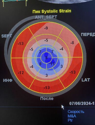  На Рівненщині патології серця діагностуватимуть за допомогою новітньої системи